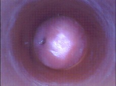 Cuello uterino gif
