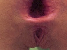 Big Anal Fisting and big Anal gaping gif