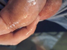 The Pleasure of Foreskin gif