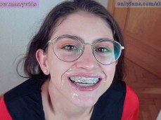 cum braces 1 gif